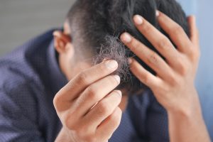 Hair loss prevention test (androgenetic alopecia)