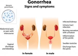 gonorrhea_diagram