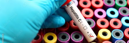 Test Tubes with Hepatitis C Tags